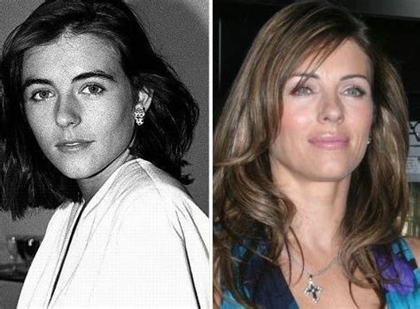 Elizabeth Hurley before and after plastic surgery 14 – Celebrity ...