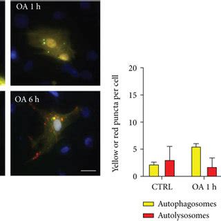 OA Enhances Autophagic Flux In Neonatal Rat Cardiomyocytes A Double