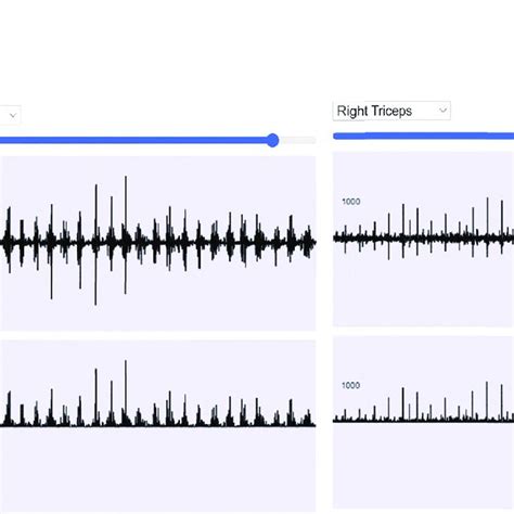 EMG Analysis Tool: Example of signal processing steps of... | Download ...