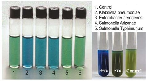 Malonate Test- Objectives, Principle, Procedure and Results