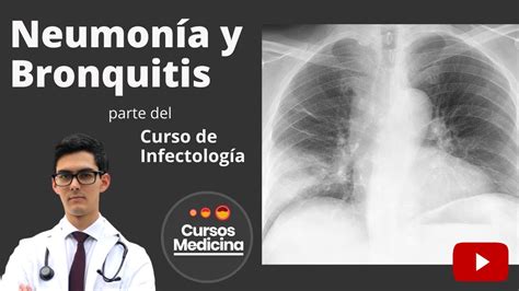 Neumonía y Bronquitis Infectología YouTube