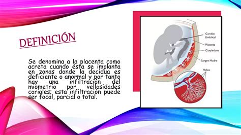 Acretismo Placentario Ppt