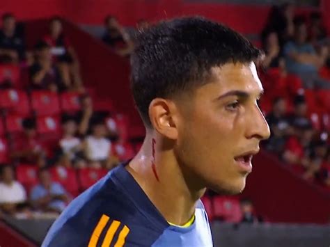 Agredieron a Leandro Brey con un vidrio en el cuello antes del arranque