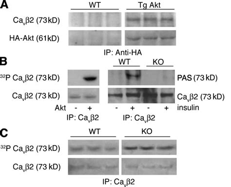 Akt interacts with and phosphorylates Cavβ2 A Coimmunoprecipitation