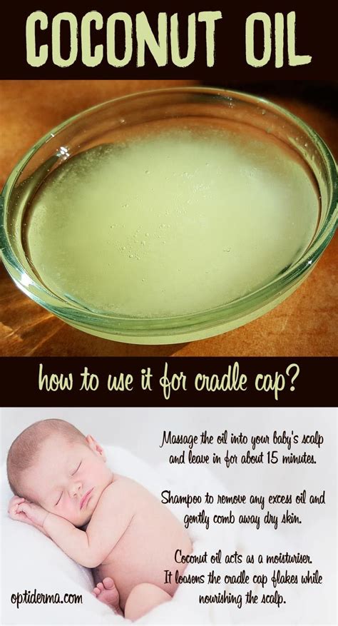 How To Use Coconut Oil For Cradle Cap If Your Baby Has Cradle Cap Don