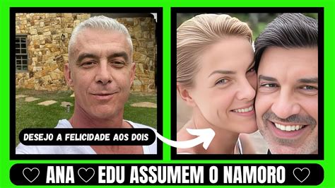 Ana Hickmann E Edu Guedes Finalmente Assumem O Namoro Agora Oficial