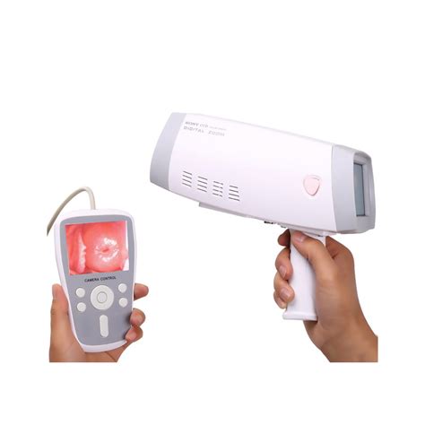 Handheld Digital Gynaecological Video Vagina Endoscope Colposcopy For