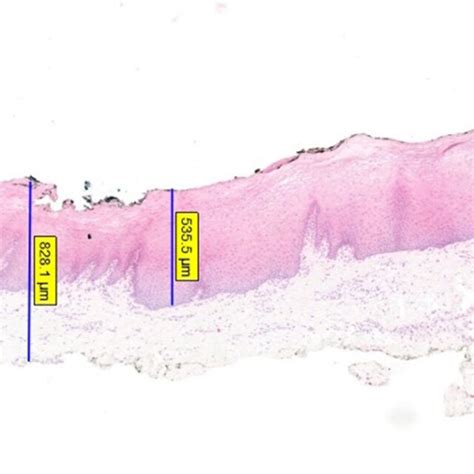 Histological Preparation Of Oral Mucosa Bmg Showing Multiple