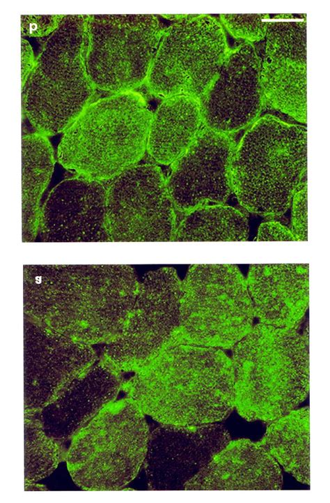 Immunofluorescent Staining Of GLUT4 In Cross Sections Of Fasting M