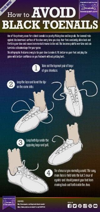 How To Avoid Black Toenails-A Complete Infographic