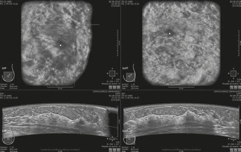 Scielo Brasil Preliminary Study Of The Technical Limitations Of