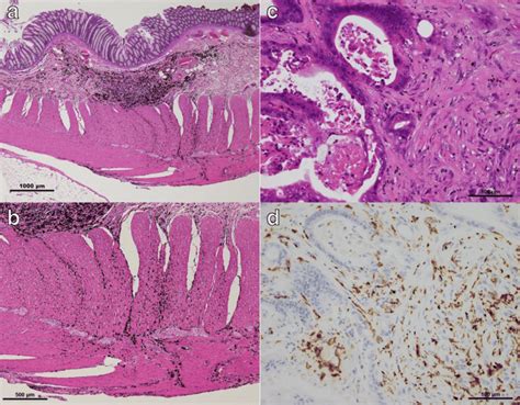 Histopathological Findings A Hematoxylin And Eosin He Staining Of Download Scientific