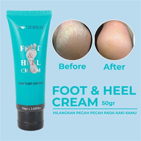 Jual Krim Tumit Obat Kaki Kapalan Pecah Kasar Kering Tumitku Cream