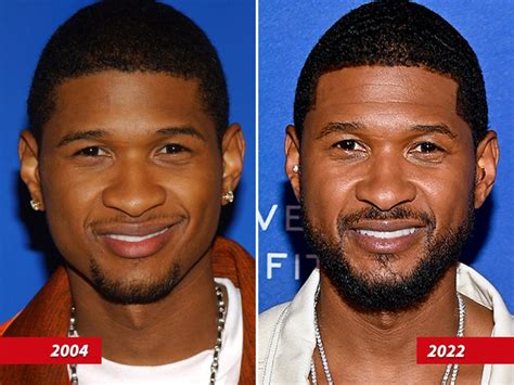 Usher -- Good Genes Or Good Docs?!