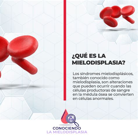 Conociendo La Mielodisplasia Behealth Micrositios