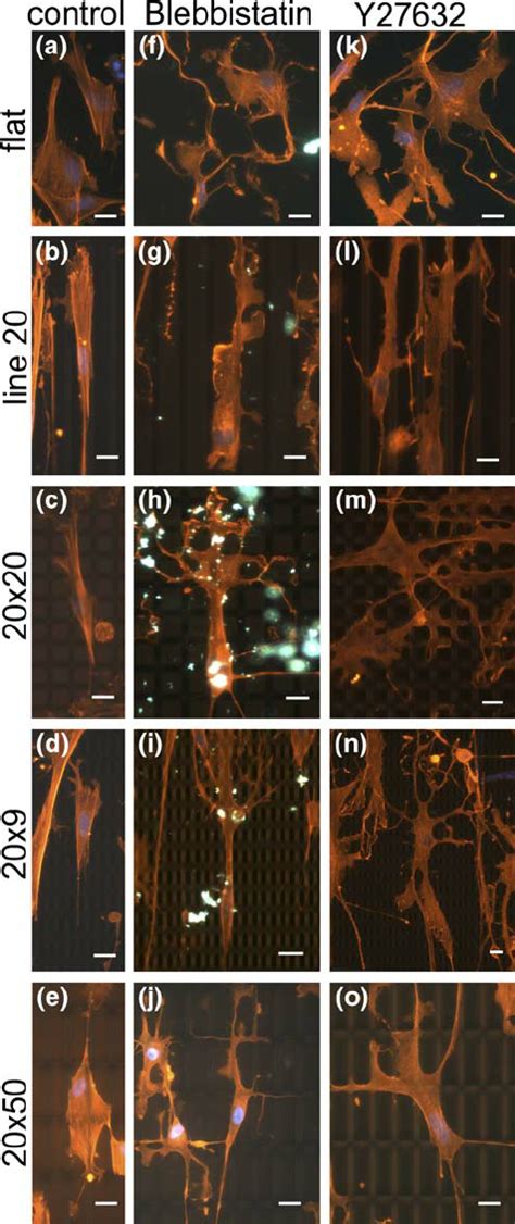 Effect Of Blebbistatin And Y27632 On Polarized Cells On TopoSurfaces