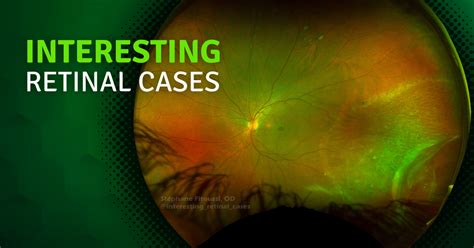 Retinal Dialysis - Fluorescene Media