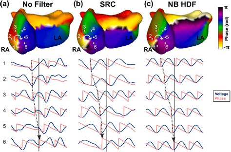 Example Of Consecutive ECGI Signals Around A Phase Singularity For Each