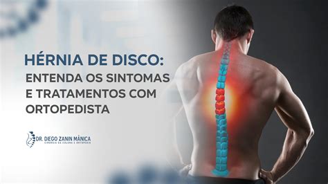 Hérnia de Disco: Sintomas e Tratamentos | Ortopedista