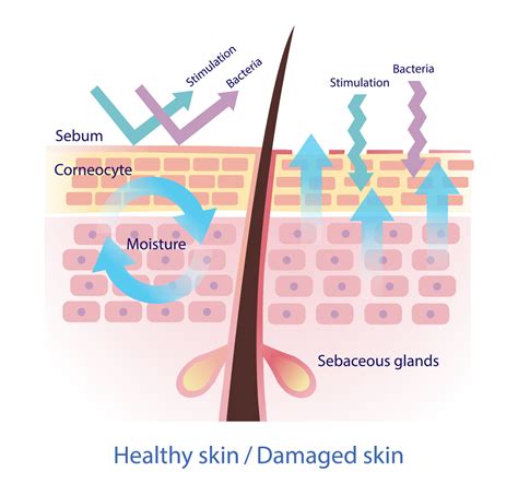 Comparison of healthy and damaged skin barrier vector on white ...