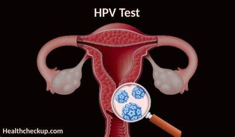 Human Papillomavirus (HPV) Test: Purpose, Preparation, Procedure