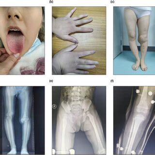 Representative Clinical Indications Of Patients In This Study A Oral