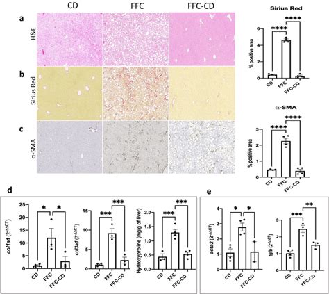 Hepatic Steatosis Fibrosis And Hepatic Stellate Cell Hsc Activation Download Scientific