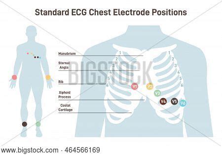 Position Ecg Chest Vector & Photo (Free Trial) | Bigstock