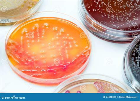 Bacterial Culture Growth On Salmonella Shigella Agar Stock Image