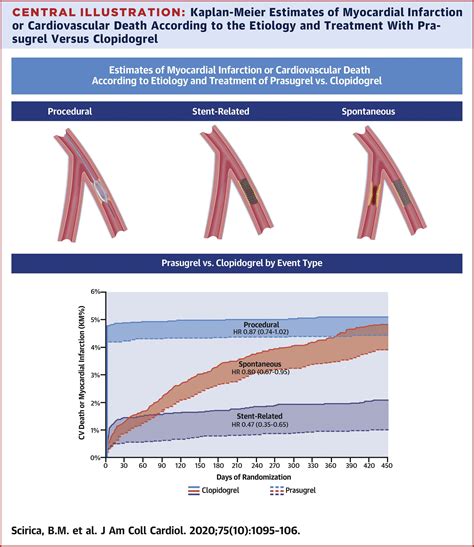 Nonculprit Lesion Myocardial Infarction Following Percutaneous Coronary