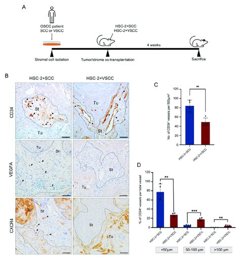 Tumor Stroma Affects Tumor Vascularization A Illustration Of