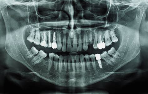 Panoramica Dentale OPT Medical Group