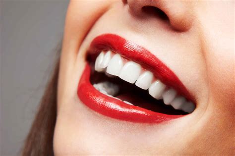 Tips On Choosing Veneer Shape And Shade Spring Haven Dental