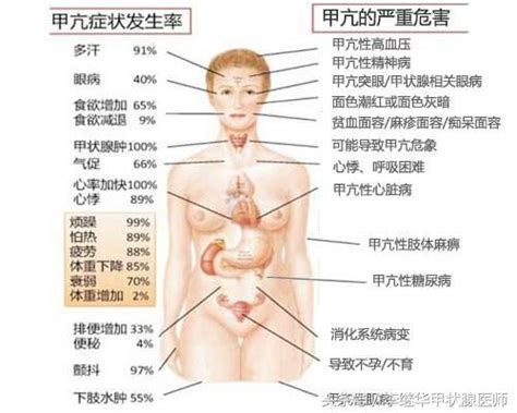 「正確認識」甲亢有哪些特殊類型 15種甲亢表現症狀 每日頭條