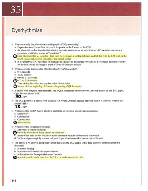 Chapter Dysrhythmias Studocu