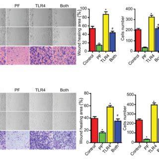 Tlr Overexpression Reduces The Effects Of Paeoniflorin On Cell