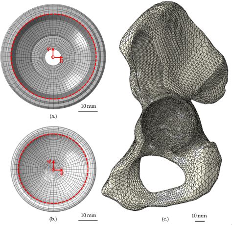 Figure From Influence Of The Acetabular Cup Material On The Shell