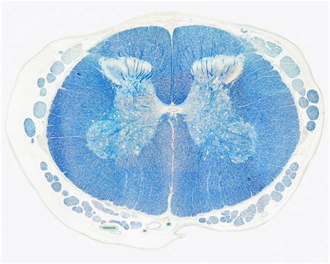 Filespinal Cord Histology 05 Embryology