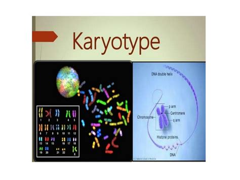 SOLUTION Sex Chromosome And Determination Studypool