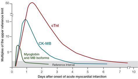 Racgp Troponin Testing In The Primary Care Setting