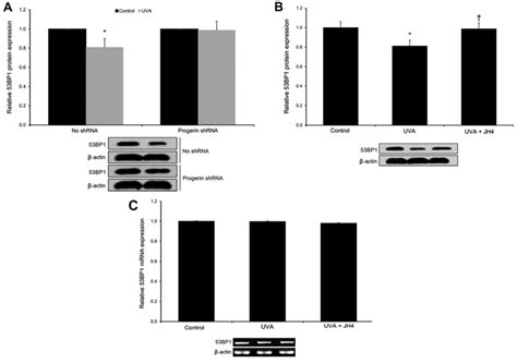 Uva Induced Upregulation Of Progerin Suppresses 53bp1‑mediated Nhej Dsb