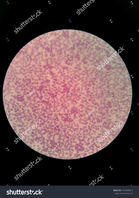 Autoagglutination Red Blood Cell Light Microscope Stock Photo (Edit Now) 1672998913