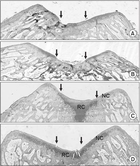 Photographs of Alcian blue stain (×40). (A) Cartilage defect only. (B ...