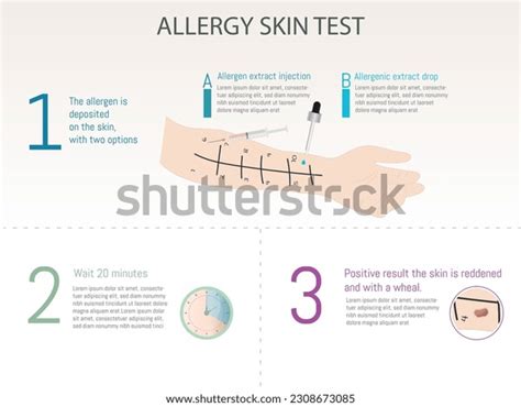 Allergy Skin Test Drop Intradermal Test Stock Vector (Royalty Free ...