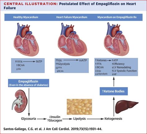 Empagliflozin Journal Of The American