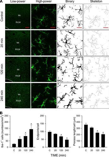 Full Article Neuroinflammation And Microglial Activation At Rostral