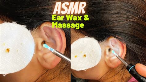 Asmr Ear Cleaning Microscope Ear Wax Removal Deep Tingly Ear Massage