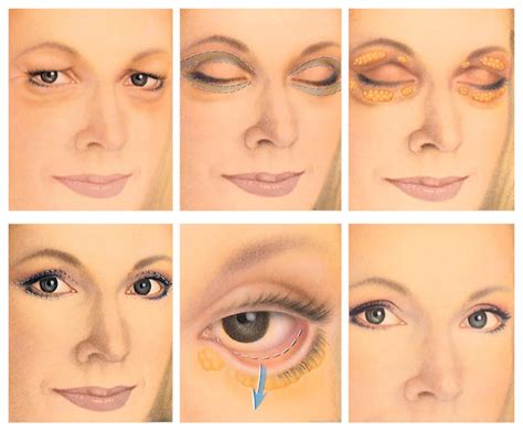 Cosmetic Therapy Blogs How Long Does It Take To Recover From Eyelid Surgery