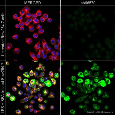 Anti-TNF alpha antibody (ab66579) | Abcam