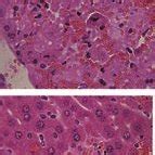 Serum Alt Level And Histological Analysis Of Livers After Anti Fas